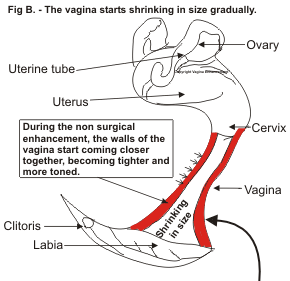 Figure B. - Represents how the vagina shrinks in size through the use of non-surgical enhancement procedures