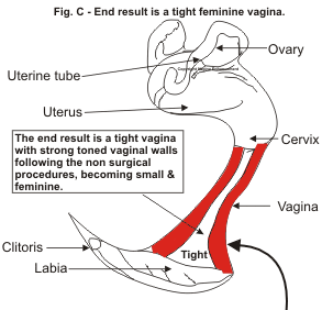 Figure C. - Represents the end results of enhancement giving you a tight feminine vagina.